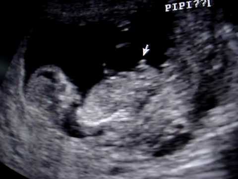 Sexo bebe en Ezpeleta-6895